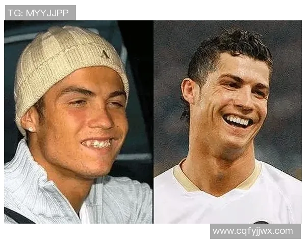 足球明星整牙的原因揭秘提升形象与自信的双重效应